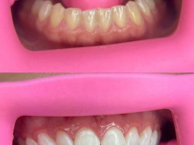 New Smile